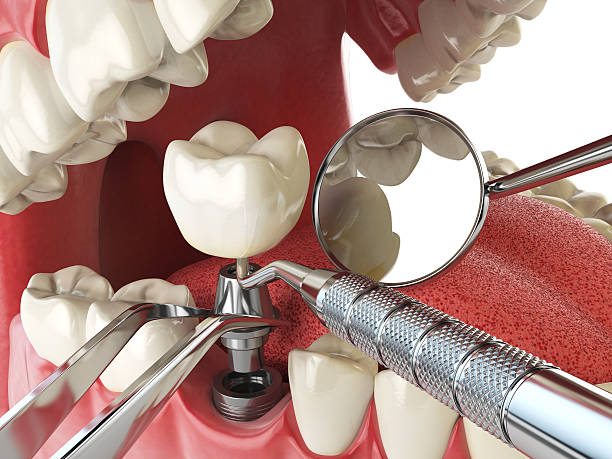 Best Emergency Dental Care for Trauma or Injury in Winter Garden, FL